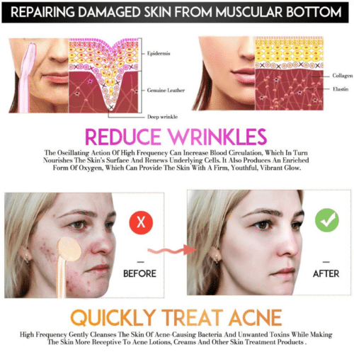 NEATCELL™ High Frequency Facial Wand 10
