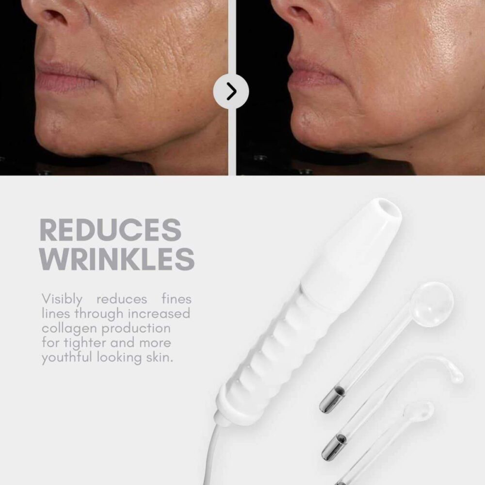 NEATCELL™ High Frequency Facial Wand 6