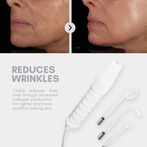 NEATCELL™ High Frequency Facial Wand 6