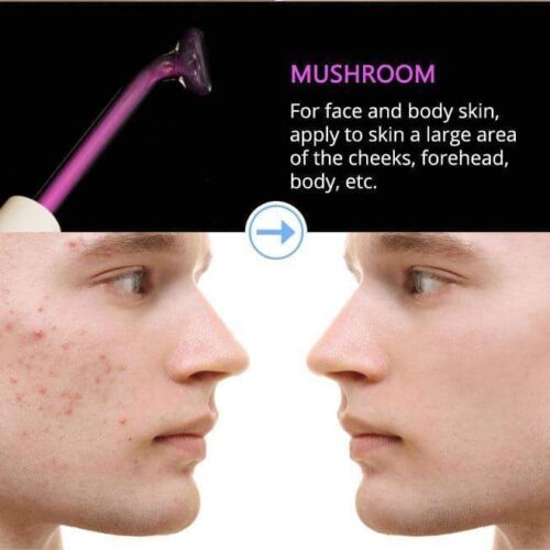 NEATCELL™ High Frequency Facial Wand 9